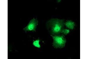 Anti-DTYMK mouse monoclonal antibody (ABIN2454996) immunofluorescent staining of COS7 cells transiently transfected by pCMV6-ENTRY DTYMK (RC201228). (DTYMK 抗体)
