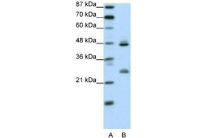 WB Suggested Anti-KLF6 Antibody Titration:  0. (KLF6 抗体  (Middle Region))