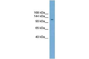 WB Suggested Anti-LIG1  Antibody Titration: 0. (LIG1 抗体  (Middle Region))