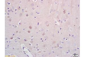 Formalin-fixed and paraffin embedded rat brain tissue labeled with Anti-NR1D1/REV-ERB alpha Polyclonal Antibody, Unconjugated (ABIN700854) at 1:200 followed by conjugation to the secondary antibody and DAB staining (NR1D1 抗体)