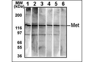 Detection of endogenous Met in HepG2 cell line. (c-MET 抗体  (Catalytic Domain))