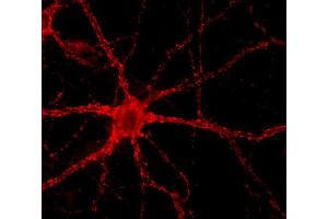 Immunocytochemistry on cultured hippocampus neurons (dilution 1 : 1000) (VAMP2 抗体  (AA 2-17))