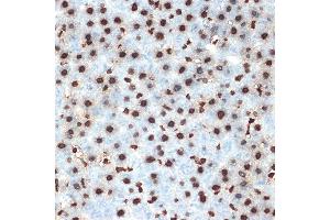 Immunohistochemistry (IHC) image for anti-Histone Cluster 4, H4 (HIST4H4) antibody (ABIN7267706)