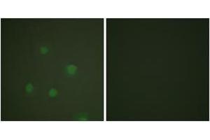 Immunofluorescence analysis of A549 cells, using Progesterone Receptor (Ab-400) Antibody. (Progesterone Receptor 抗体  (AA 371-420))