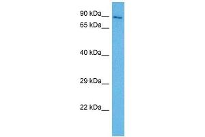 Host:  Rabbit  Target Name:  FURIN  Sample Tissue:  Mouse Testis  Antibody Dilution:  1ug/ml (FURIN 抗体  (N-Term))