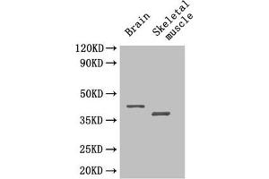 Western Blot Positive WB detected in: Mouse brain tissue, Mouse skeletal muscle tissue All lanes: SEPP1 antibody at 4 μg/mL Secondary Goat polyclonal to rabbit IgG at 1/50000 dilution Predicted band size: 43 kDa Observed band size: 43, 40 kDa (Selenoprotein P (SELENOP) (AA 20-381) 抗体)