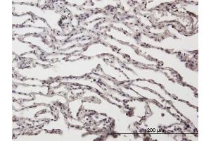 Immunoperoxidase of purified MaxPab antibody to ADAR on formalin-fixed paraffin-embedded human lung. (ADAR 抗体  (AA 1-1226))