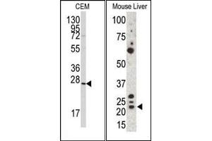 Image no. 1 for anti-Gremlin 1 (GREM1) (C-Term) antibody (ABIN358612) (GREM1 抗体  (C-Term))