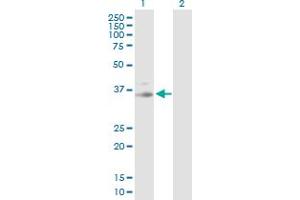 Western Blot analysis of PRKG1 expression in transfected 293T cell line by PRKG1 MaxPab polyclonal antibody. (PRKG1 抗体  (AA 1-312))