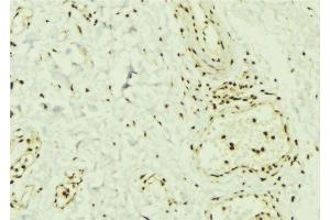 ABIN6269369 at 1/100 staining Mouse muscle tissue by IHC-P. (SMAD1 抗体)