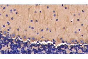 Detection of TNFa in Mouse Cerebellum Tissue using Polyclonal Antibody to Tumor Necrosis Factor Alpha (TNFa) (TNF alpha 抗体  (AA 80-235))