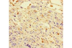 Immunohistochemistry (IHC) image for anti-DnaJ (Hsp40) Homolog, Subfamily C, Member 3 (DNAJC3) (AA 277-496) antibody (ABIN7150550)