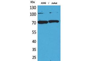 Western Blotting (WB) image for anti-X-Ray Repair Complementing Defective Repair in Chinese Hamster Cells 6 (XRCC6) (Ser403) antibody (ABIN3178361) (XRCC6 抗体  (Ser403))