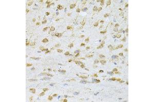 Immunohistochemistry of paraffin-embedded mouse brain using VAPB Antibody (ABIN1876551) at dilution of 1:200 (40x lens). (VAPB 抗体)