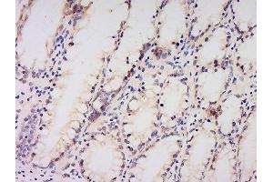 Immunohistochemistry (Paraffin-embedded Sections) (IHC (p)) image for anti-Protein Kinase, AMP-Activated, alpha 1 Catalytic Subunit (PRKAA1) (AA 351-450) antibody (ABIN737886)