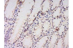 Formalin-fixed and paraffin embedded human kidney labeled with Anti-AMPK alpha-1 Polyclonal Antibody, Unconjugated  at 1:200 followed by conjugation to the secondary antibody and DAB staining.