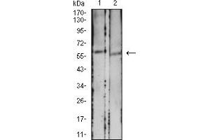 Western Blotting (WB) image for anti-Ectonucleoside Triphosphate diphosphohydrolase 1 (ENTPD1) (AA 38-179) antibody (ABIN5684124)