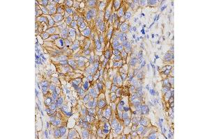 Immunohistochemistry (IHC) image for anti-Pepsinogen C (PGC) (AA 100-200) antibody (ABIN3016695)
