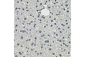 Immunohistochemistry of paraffin-embedded mouse liver using SMN2 antibody (ABIN5974442) (40x lens). (SMN2 抗体)