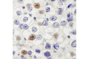 Immunohistochemistry (IHC) image for anti-Discs, Large (Drosophila) Homolog-Associated Protein 5 (DLGAP5) (AA 200-250) antibody (ABIN7448603)
