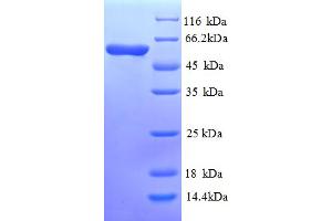 SDS-PAGE (SDS) image for Cystathionine-beta-Synthase (CBS) (AA 1-507), (full length) protein (His tag) (ABIN5712920) (CBS Protein (AA 1-507, full length) (His tag))