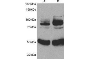 Western Blotting (WB) image for Adaptor Protein, phosphotyrosine Interaction, PH Domain and Leucine Zipper Containing 1 (APPL1) peptide (ABIN369506) (Adaptor Protein, phosphotyrosine Interaction, PH Domain and Leucine Zipper Containing 1 (APPL1) Peptide)