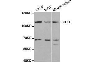 Western blot analysis of extracts of various cell lines, using CBLB antibody. (Cbl Proto-Oncogene B, E3 Ubiquitin Protein Ligase (CBLB) 抗体)