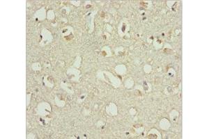 Immunohistochemistry of paraffin-embedded human brain tissue using ABIN7151541 at dilution of 1:100 (EEF1B2 抗体  (AA 1-225))