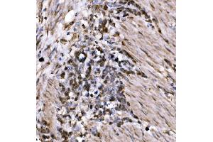 IHC analysis of KLF15 using anti-KLF15 antibody (ABIN7599269).