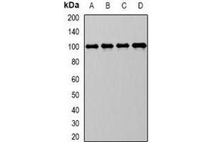 Western blot analysis of CD10 expression in Raji (A), MCF7 (B), mouse kidney (C), mouse liver (D) whole cell lysates. (MME 抗体)