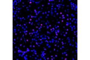 Immunofluorescent analysis of paraformaldehyde-fixed rat kidney using ADRA1B (ABIN7072974) at dilution of 1: 1200 (ADRA1B 抗体)