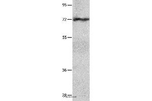 Western blot analysis of Hela cell  , using IGF2BP1 Polyclonal Antibody at dilution of 1:750 (IGF2BP1 抗体)