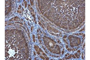 IHC-P Image ATG4D antibody [N3C3] detects ATG4D protein at cytoplasm in mouse ovary by immunohistochemical analysis. (ATG4D 抗体  (Center))