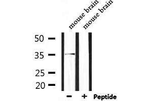 Western blot analysis of extracts from mouse brain, using Olfactory receptor 5AP2 Antibody. (OR5AP2 抗体)