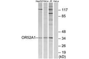 Western Blotting (WB) image for anti-Olfactory Receptor, Family 52, Subfamily A, Member 1 (OR52A1) (AA 20-69) antibody (ABIN2891124) (OR52A1 抗体  (AA 20-69))