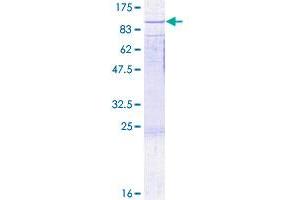 RAD17 Protein (RAD17) (AA 1-584) (GST tag)