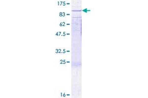 RAD17 Protein (RAD17) (AA 1-584) (GST tag)