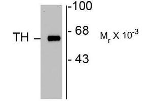 Image no. 1 for anti-Tyrosine Hydroxylase (TH) antibody (ABIN372734) (Tyrosine Hydroxylase 抗体)