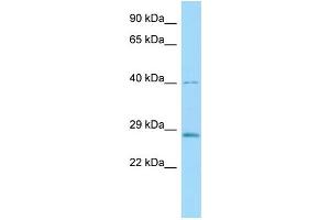 Host: Rabbit Target Name: Cela3b Sample Type: Rat Pancreas lysates Antibody Dilution: 1. (Elastase 3B 抗体  (Middle Region))