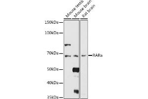 Western blot analysis of extracts of various cell lines, using RARα antibody (ABIN6128615, ABIN6146692, ABIN6146695 and ABIN6213825) at 1:1000 dilution. (Retinoic Acid Receptor alpha 抗体  (AA 1-457))