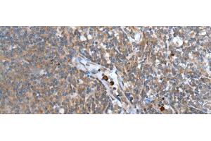 Immunohistochemistry of paraffin-embedded Human tonsil tissue using WISP2 Polyclonal Antibody at dilution of 1:45(x200) (WISP2 抗体)