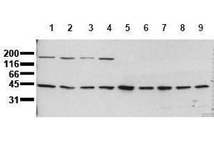 Western Blotting (WB) image for anti-Mitogen-Activated Protein Kinase Kinase 1 (MAP2K1) antibody (ABIN126835) (MEK1 抗体)