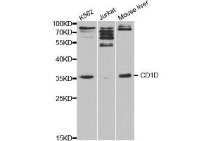 Western blot analysis of extracts of various cell lines, using CD1D antibody. (CD1d 抗体  (AA 20-190))