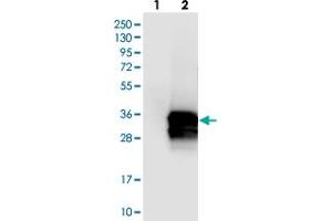 Western blot analysis of Lane 1: Negative control (vector only transfected HEK293T lysate), Lane 2: Over-expression Lysate (Co-expressed with a C-terminal myc-DDK tag (~3. (Calretinin 抗体)