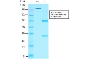 SDS-PAGE Analysis Purified NKX2. (Recombinant Nkx2-2 抗体  (AA 1-119))