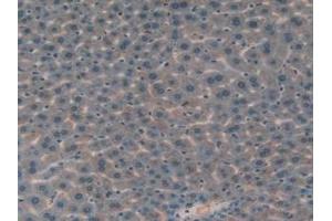 Detection of IGFBP7 in Mouse Liver Tissue using Polyclonal Antibody to Insulin Like Growth Factor Binding Protein 7 (IGFBP7) (IGFBP7 抗体  (AA 88-281))