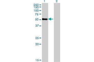 Western Blot analysis of ZNF232 expression in transfected 293T cell line by ZNF232 monoclonal antibody (M06), clone 1F8. (ZNF232 抗体  (AA 181-280))