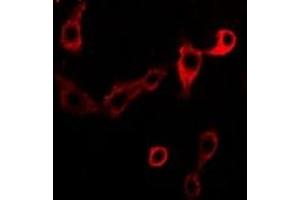 Immunofluorescent analysis of Adenosine Deaminase staining in Jurkat cells. (ADA 抗体)