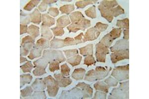 Immunohistochemistry analysis in human skeletal muscle (Formalin-fixed, Paraffin-embedded) using SRBD1  Antibody  (C-term), followed by peroxidase conjugation of the secondary antibody and DAB staining. (SRBD1 抗体  (C-Term))
