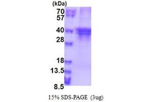 SDS-PAGE (SDS) image for ST3 beta-Galactoside alpha-2,3-Sialyltransferase 5 (ST3GAL5) (AA 83-418) protein (His tag) (ABIN5853358) (ST3GAL5 Protein (AA 83-418) (His tag))